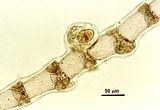 5 – Tetrasporociste parzialmente avvolta dal filamento involucrale